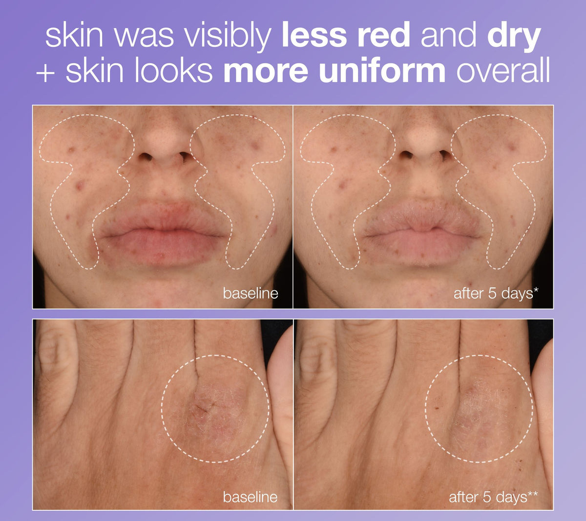 PRO stabilizing repair serum
