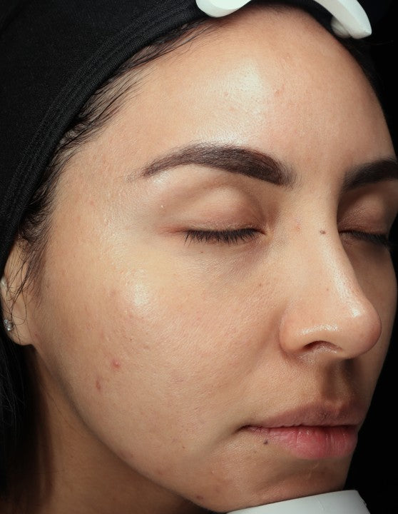 Before - Patient B
