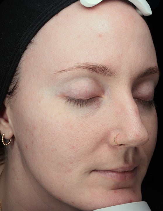 After - Patient C