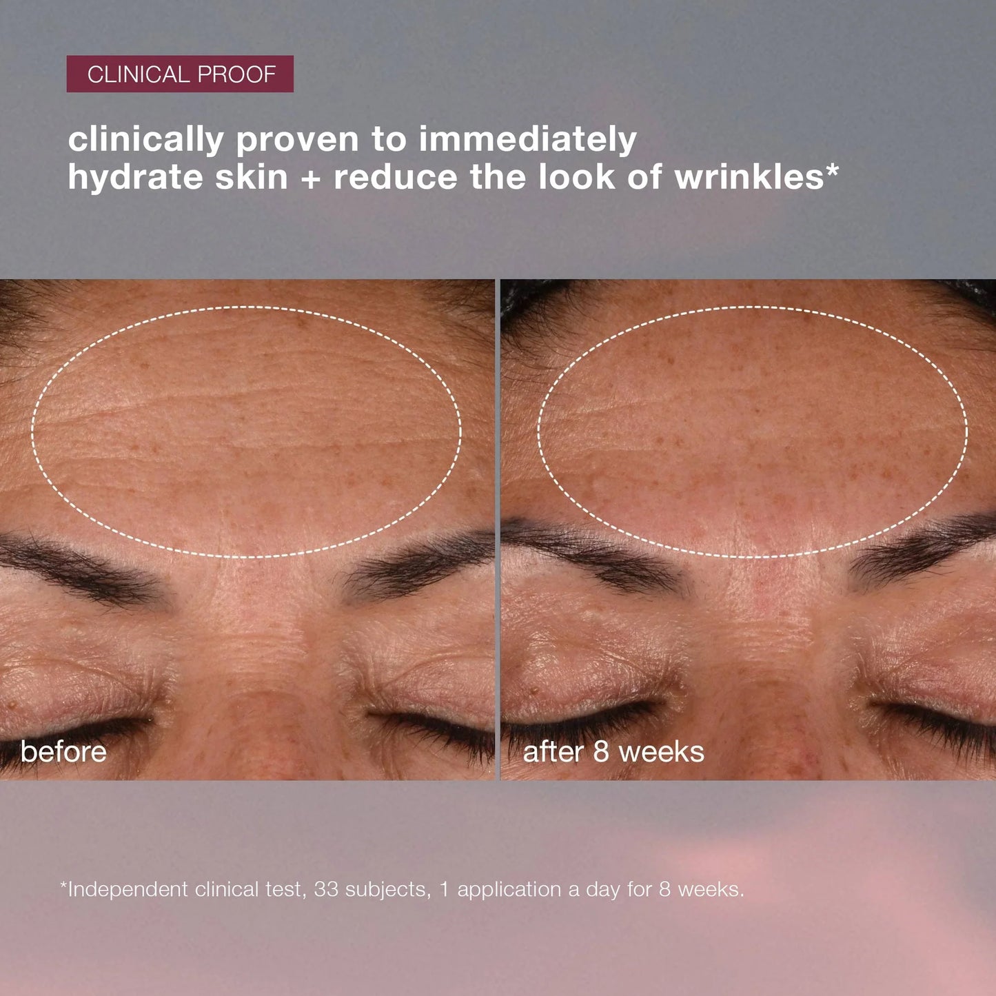 dynamic skin recovery spf 50