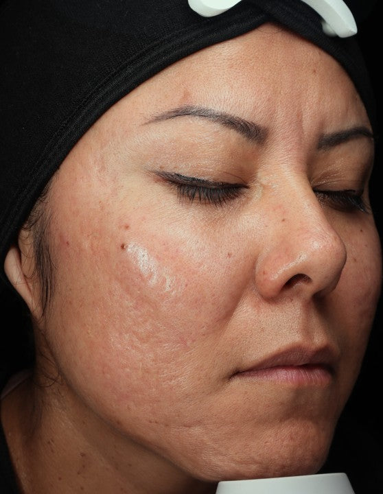 Before - Patient A
