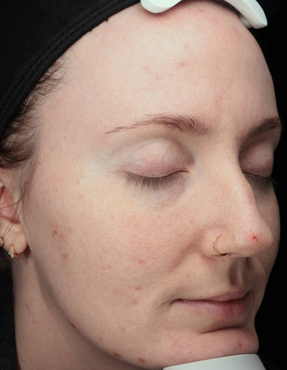 Before - Patient C